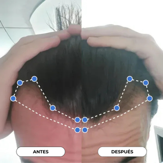 Suero en Roll - On para el crecimiento del cabello