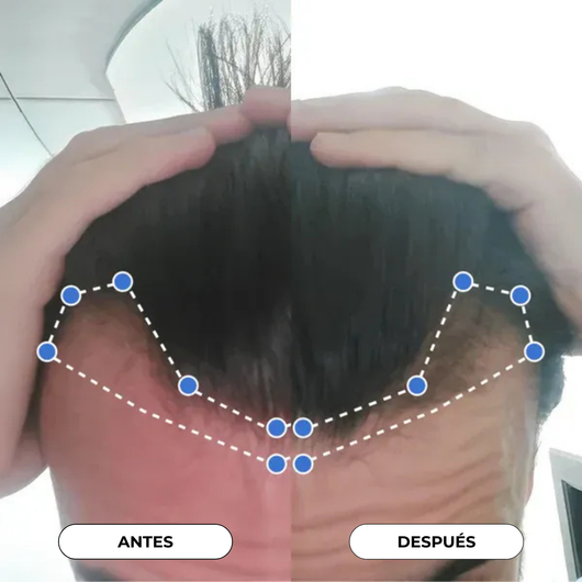 Suero en Roll - On para el crecimiento del cabello