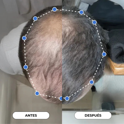 Suero en Roll - On para el crecimiento del cabello