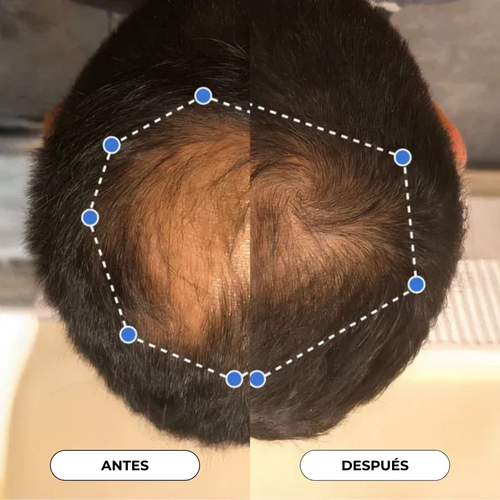 Suero en Roll - On para el crecimiento del cabello