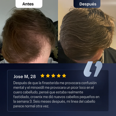 Suero en Roll - On para el crecimiento del cabello