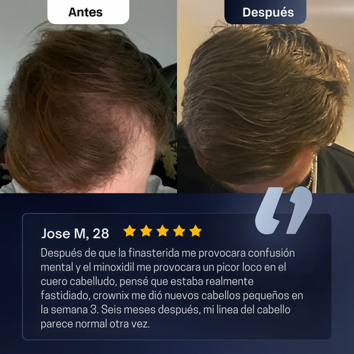 Suero en Roll - On para el crecimiento del cabello